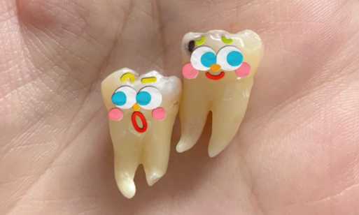 拔牙的止血棉花会不会留在牙齿里 拔牙后为什么咬棉球